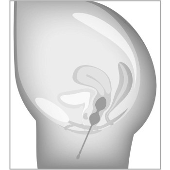 Beau Coeur ELORIN Loveball Training Set