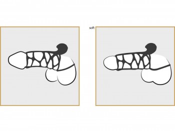 Fantasy X-Tensions Extreme Silicone Power Cage